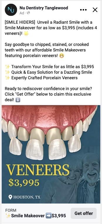 NU Dentistry — veneers