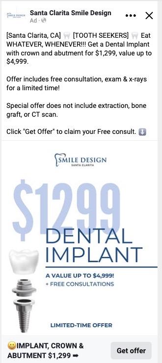 Santa Clarita Smile Design — implants